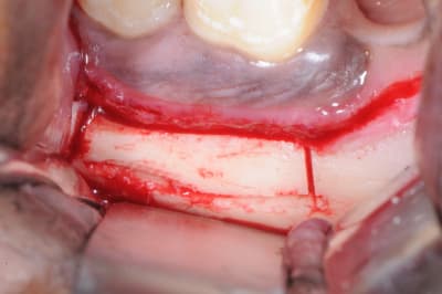 Dsc 0610 cw7isi - Eugenol