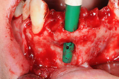 Dsc 0621 inmqpn - Eugenol