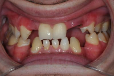 Dsc 0782 d6xswd - Eugenol