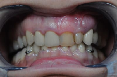 Dsc 1000 dwbd5j - Eugenol