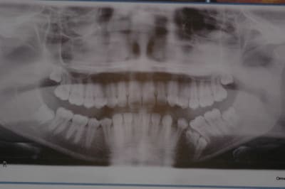 Dsc 1079 oxnvtw - Eugenol