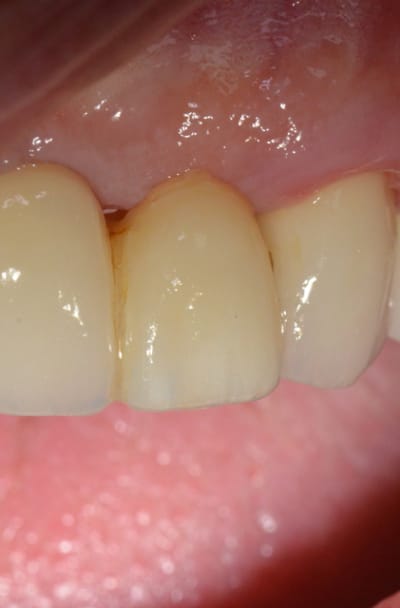 Dsc 1237 wn1vqt - Eugenol