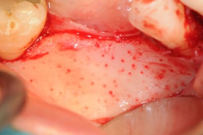 Dsc 1401 efcyid - Eugenol