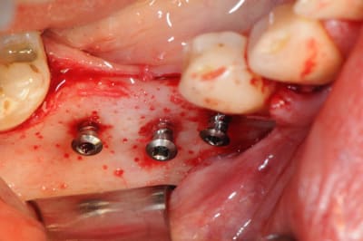 Dsc 1407 obuilt - Eugenol