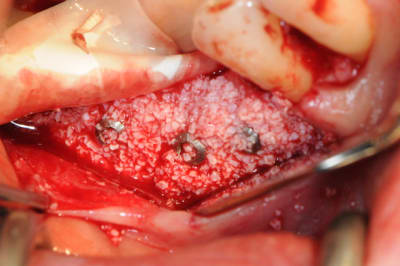 Dsc 1414 nlziwc - Eugenol