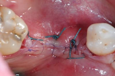 Dsc 1417 bxlrpx - Eugenol