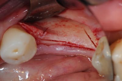 Dsc 1419 adxdla - Eugenol