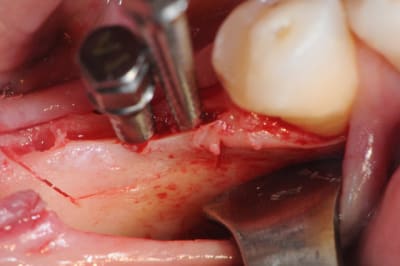 Dsc 1427 p9vc3n - Eugenol