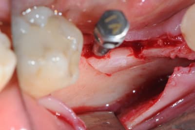 Dsc 1428 cdoi8n - Eugenol