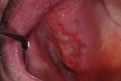 Dsc 1531 o7yaou - Eugenol