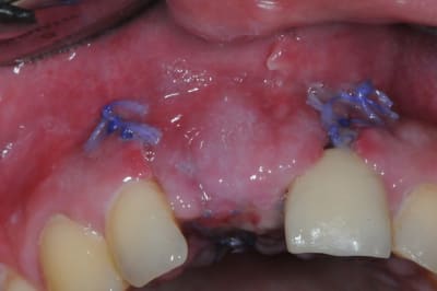 Dsc 1551 spbyqr - Eugenol