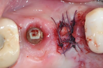 Dsc 1555 dztagv - Eugenol