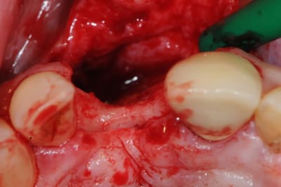 Dsc 1572 oxauwq - Eugenol