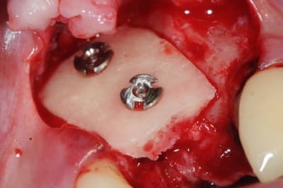 Dsc 1646 qmcvdq - Eugenol