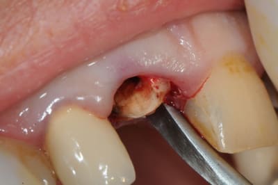 Dsc 1685 rv9jrz - Eugenol