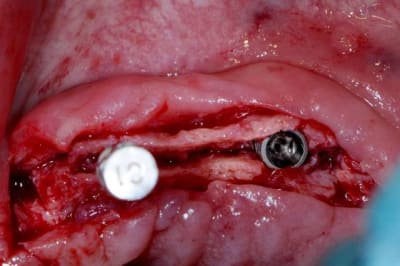 Dsc 1700 khmpg0 - Eugenol