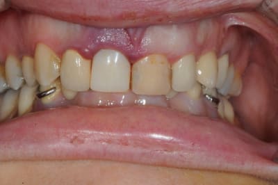 Dsc 1787 fiq0yh - Eugenol