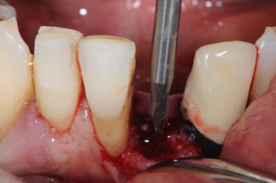 Dsc 2527 iqwtsl - Eugenol