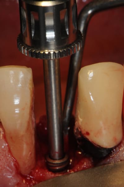 Dsc 2543 bpesu5 - Eugenol