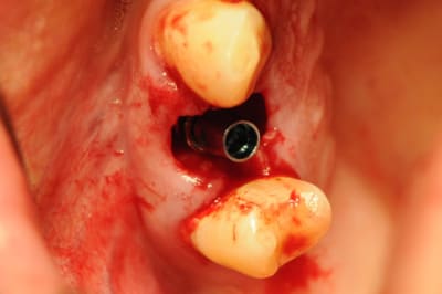 Dsc 2562 ic3m2l - Eugenol