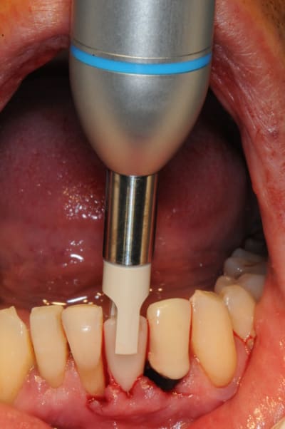 Dsc 2583 x0u8t5 - Eugenol