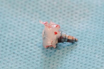 Dsc 2589 mcawkl - Eugenol