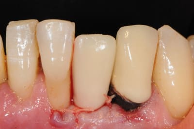 Dsc 2595 vp867w - Eugenol