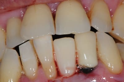 Dsc 2598 jmgbfq - Eugenol