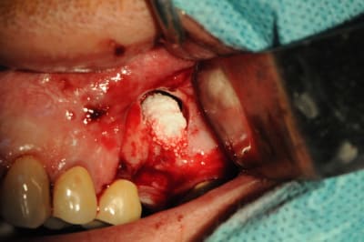 Dsc 2841 vhiord - Eugenol