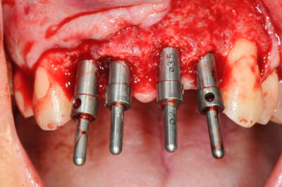 Dsc 2997 shq9iq - Eugenol