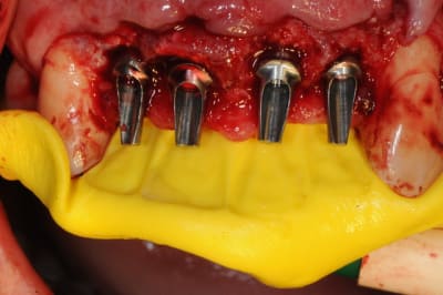 Dsc 2998 yjbxig - Eugenol