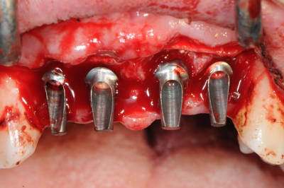 Dsc 3008 ecszox - Eugenol