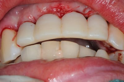 Dsc 3025 lluew1 - Eugenol