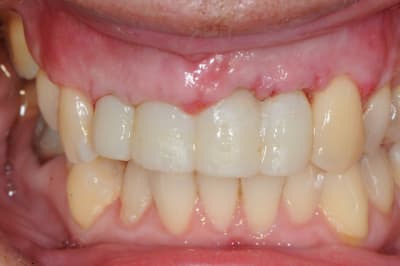 Dsc 3069 eihn7q - Eugenol