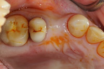 Dsc 3124 o770pg - Eugenol