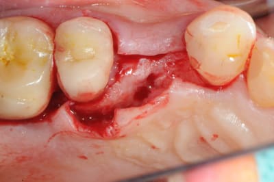 Dsc 3125 hnm34m - Eugenol