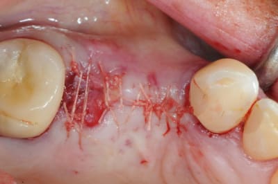 Dsc 3141 ymdb1o - Eugenol