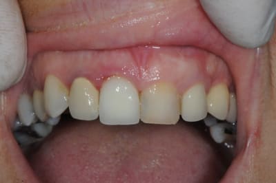 Dsc 3276 n3alb5 - Eugenol