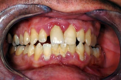 Dsc 3482 zzaqpk - Eugenol