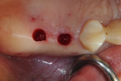 Dsc 3560 lfxhnv - Eugenol