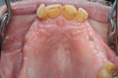 Dsc 3630 i6tenr - Eugenol