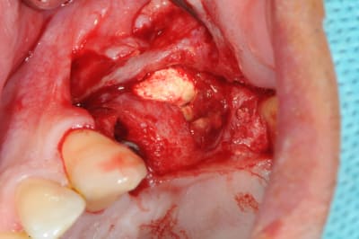 Dsc 3651 nuv7sq - Eugenol