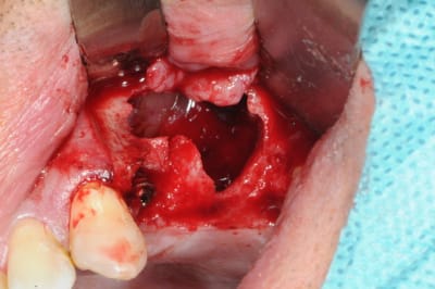 Dsc 3666 xbow3b - Eugenol