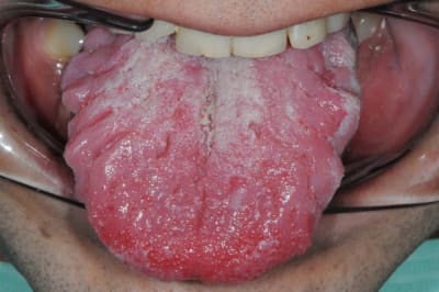 Dsc 3860 rp8rbl - Eugenol