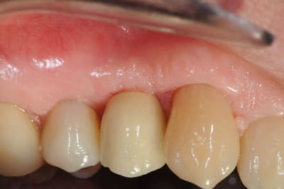 Dsc 3873 aeqasj - Eugenol
