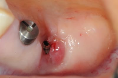 Dsc 3880 sk998k - Eugenol