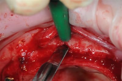 Dsc 3964 nmglmg - Eugenol