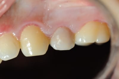 Dsc 4085 kv6j3j - Eugenol