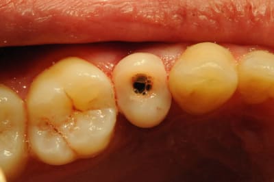 Dsc 4138 zw0cnz - Eugenol