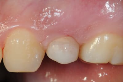 Dsc 4212 ld8vnc - Eugenol